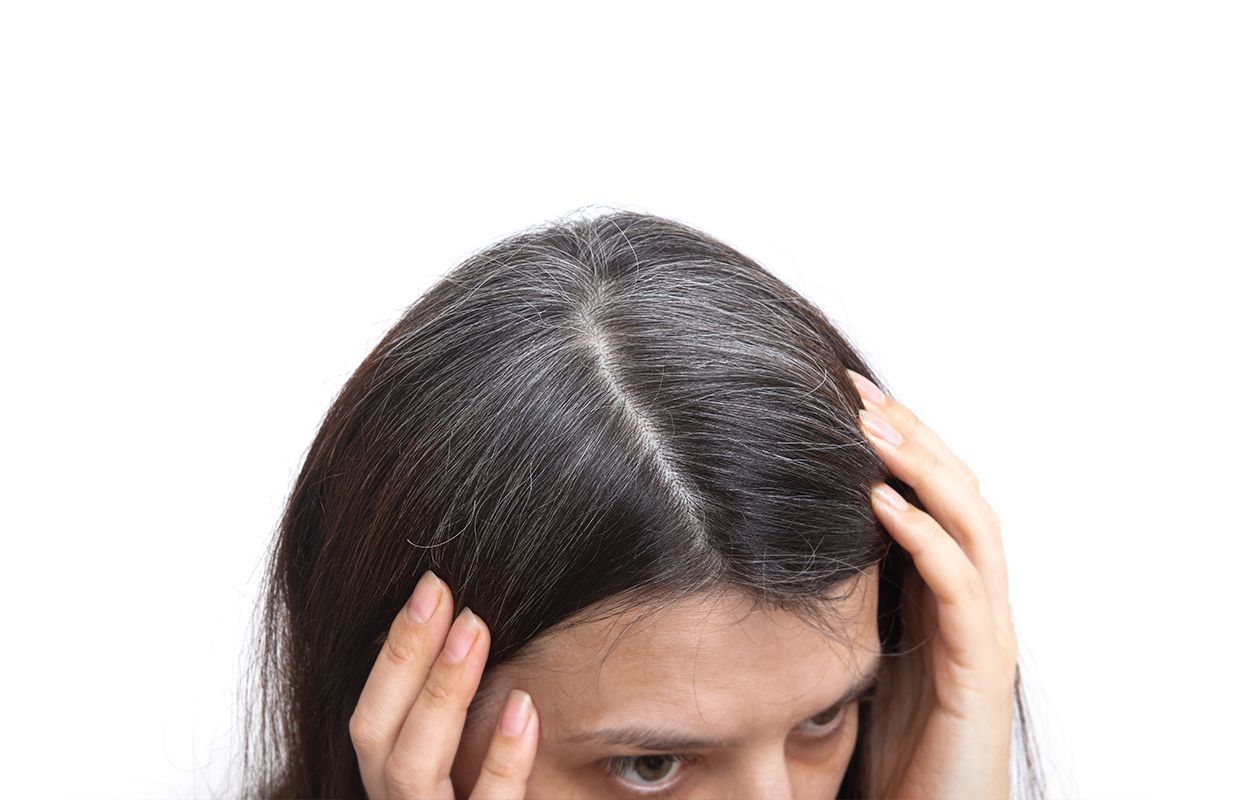 A worried woman showing thin hair and greying